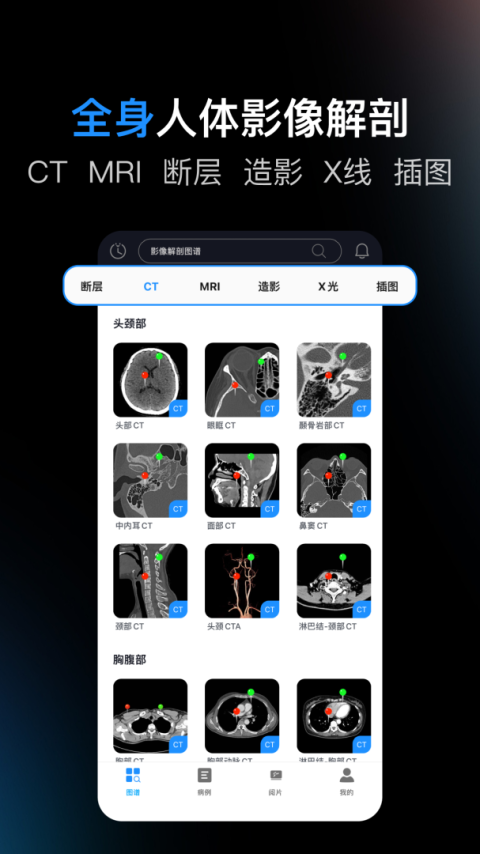 影像解剖图谱app