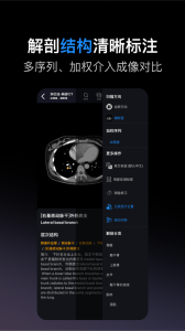影像解剖图谱app