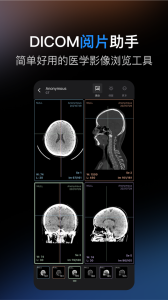 影像解剖图谱app