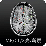 影像解剖图谱app