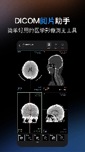 影像解剖图谱app