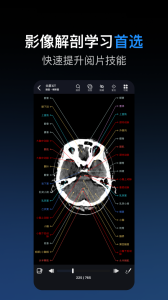 影像解剖图谱app