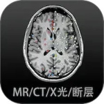 影像解剖图谱app